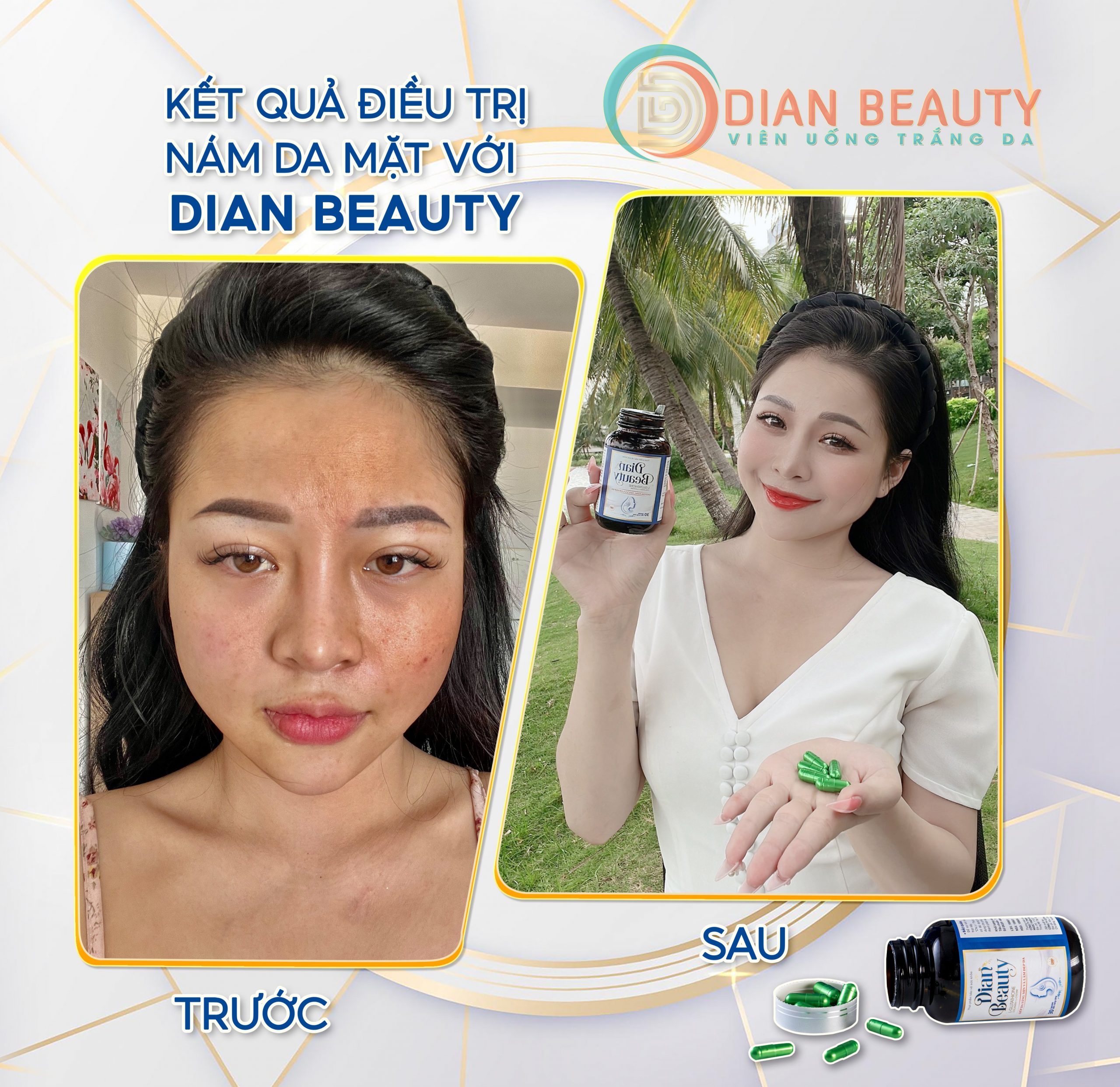viên uống dian beauty