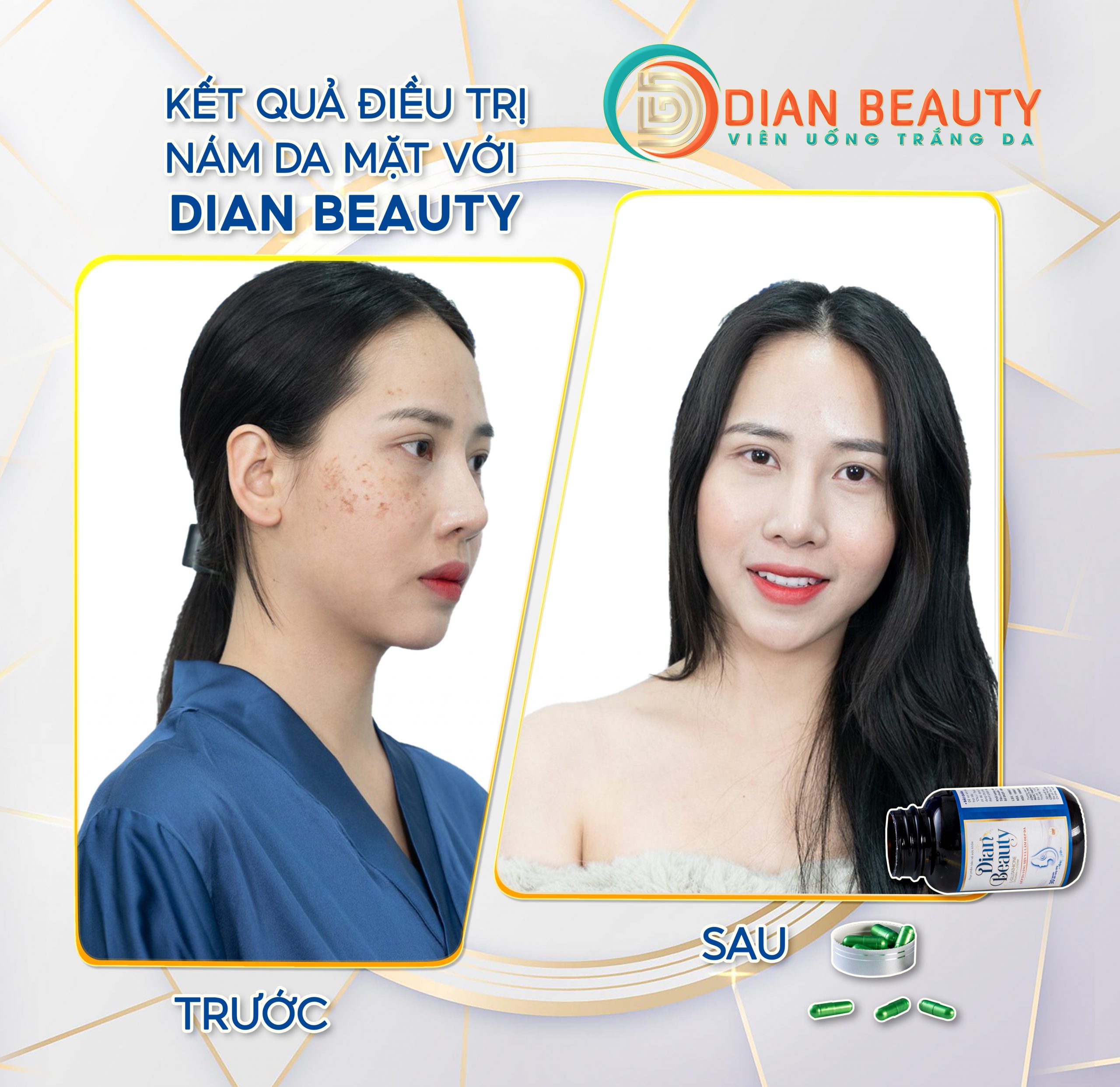 viên uống dian beauty