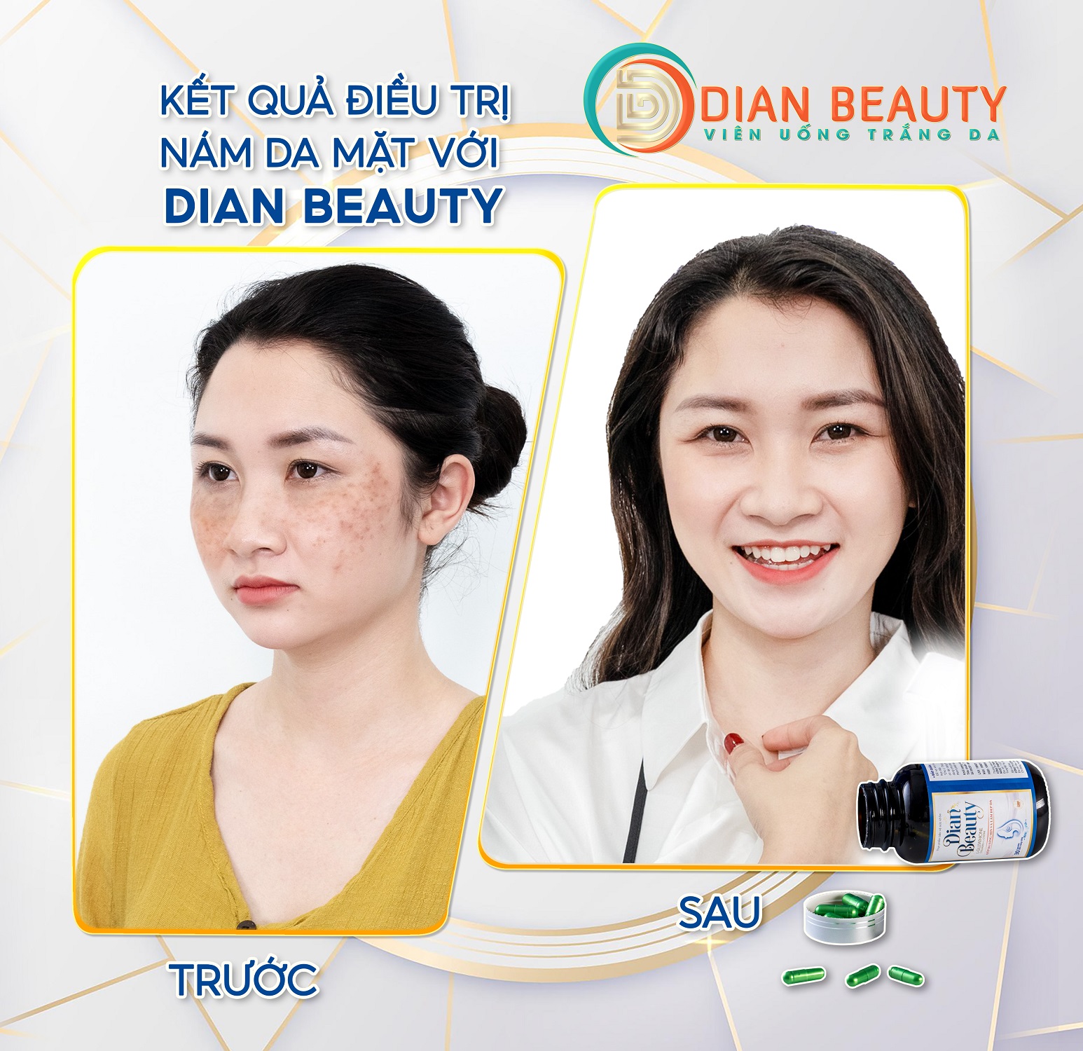 viên uống dian beauty