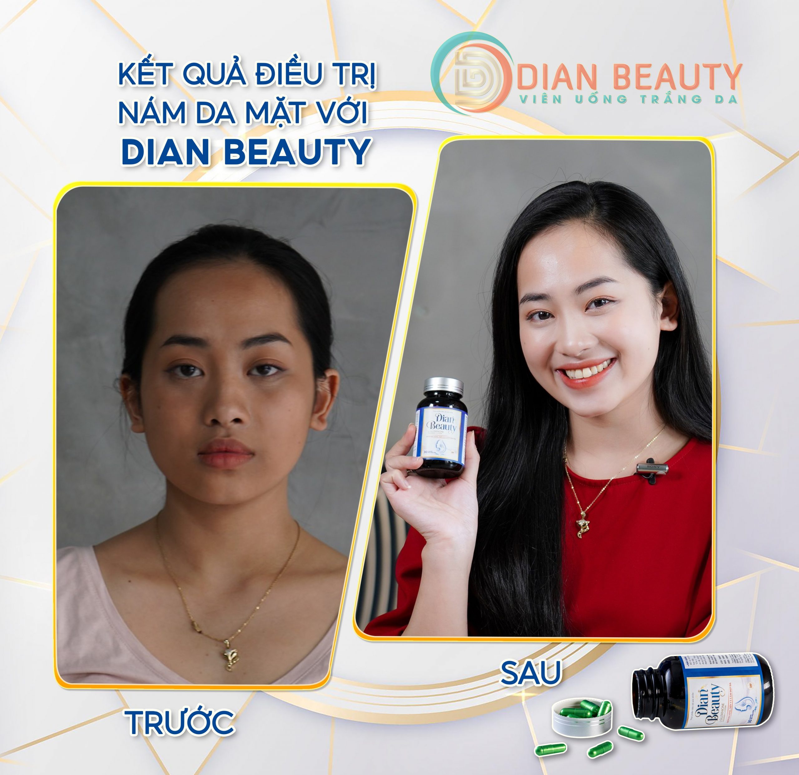 viên uống dian beauty