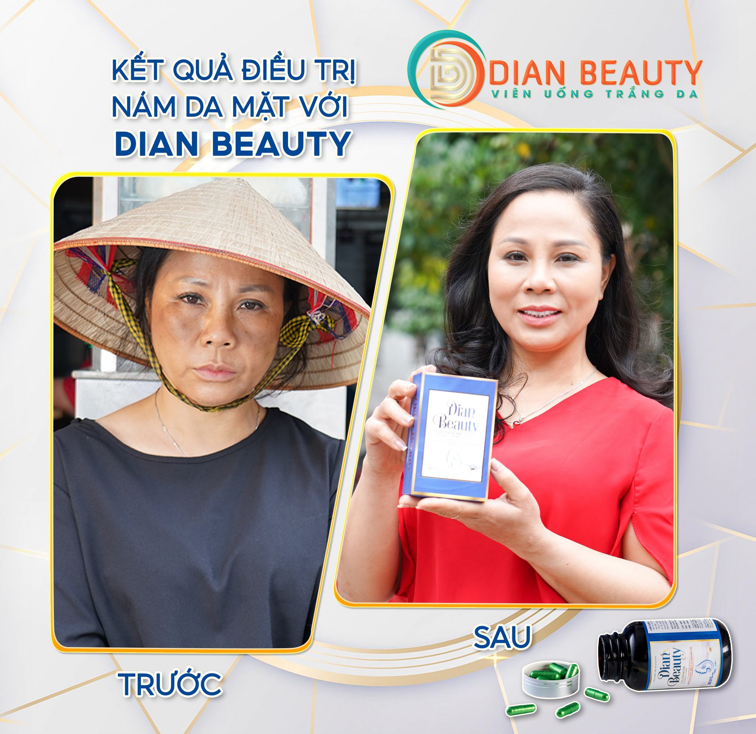 viên uống dian beauty