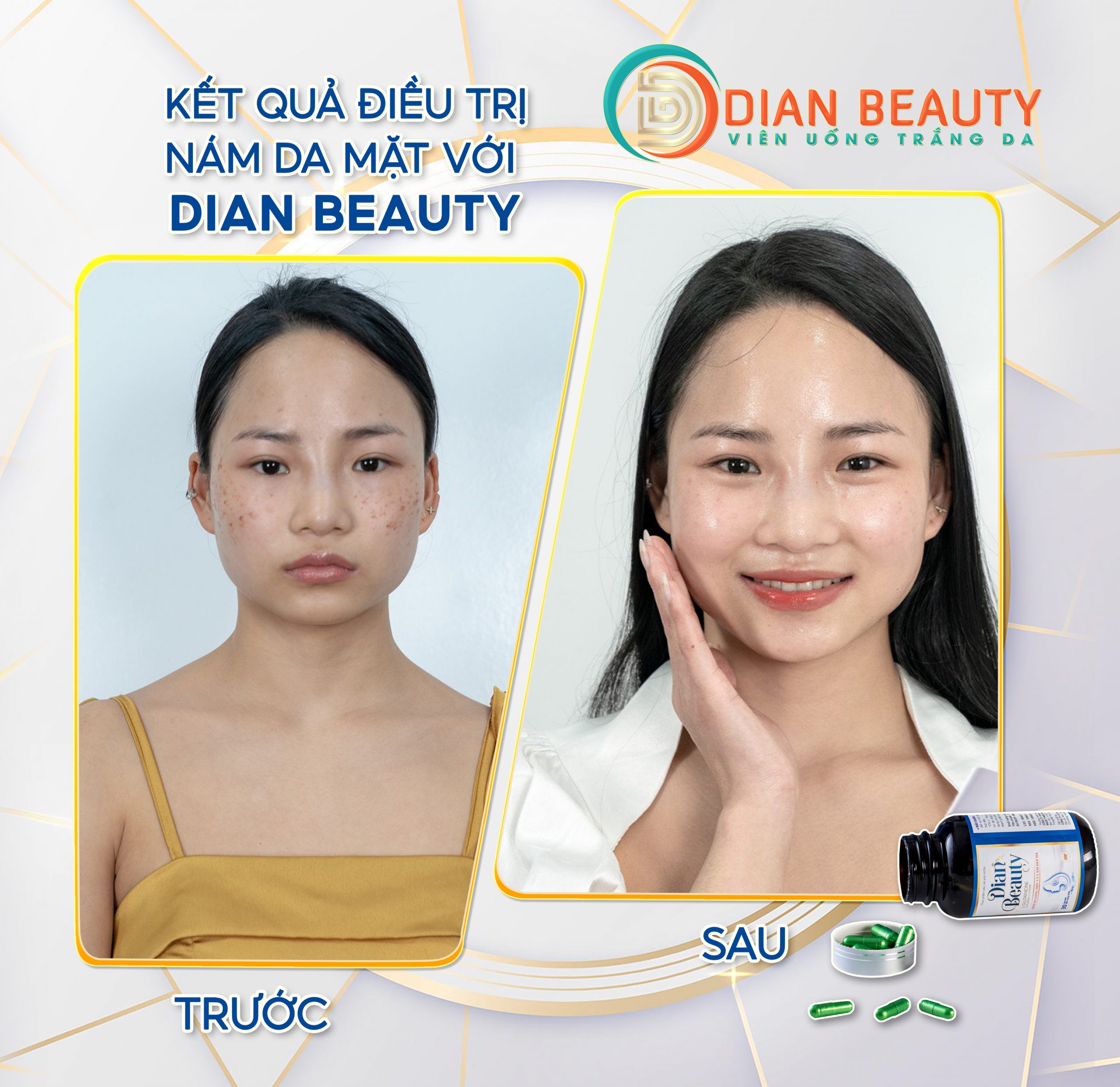 viên uống dian beauty