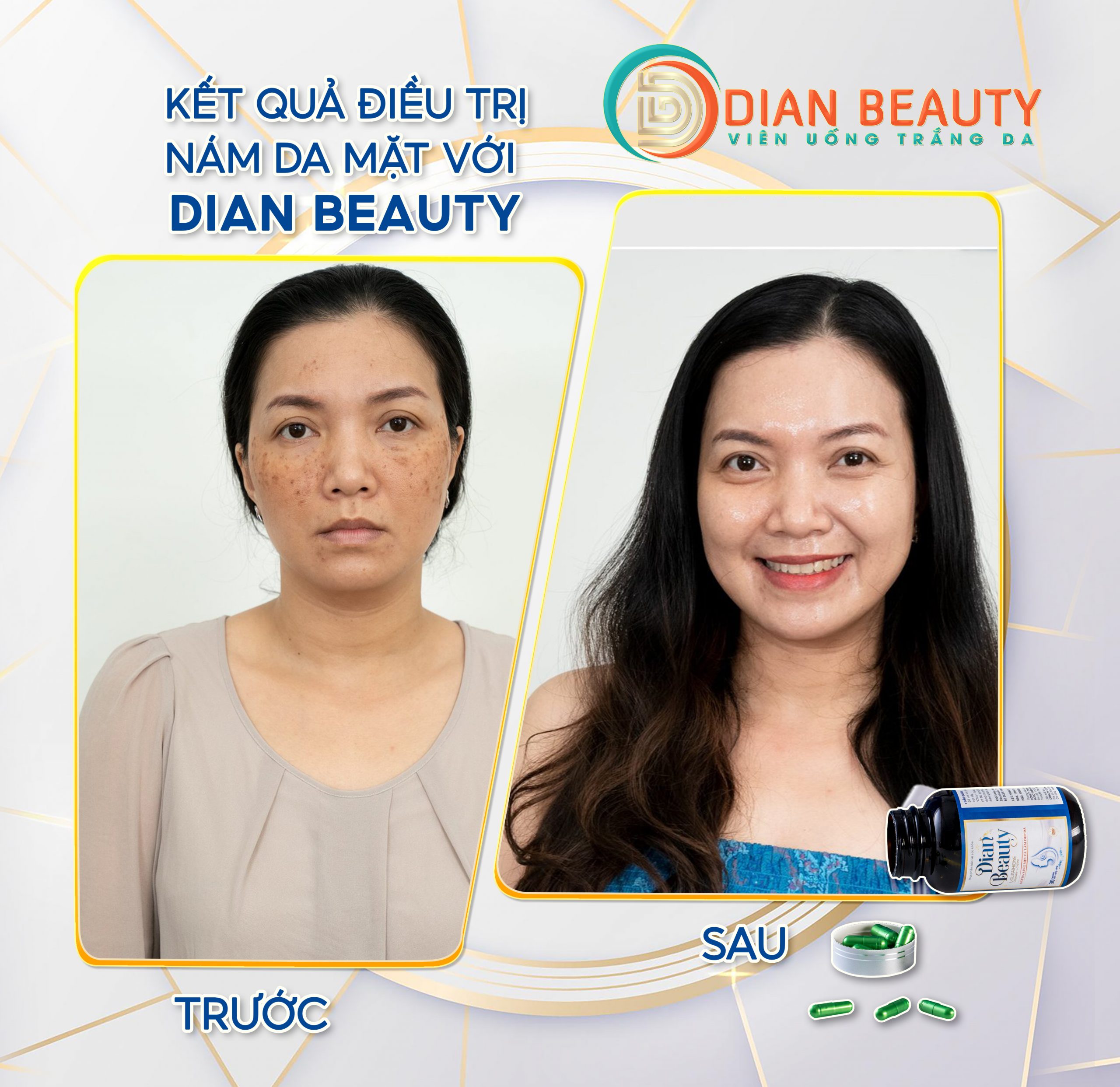 viên uống dian beauty
