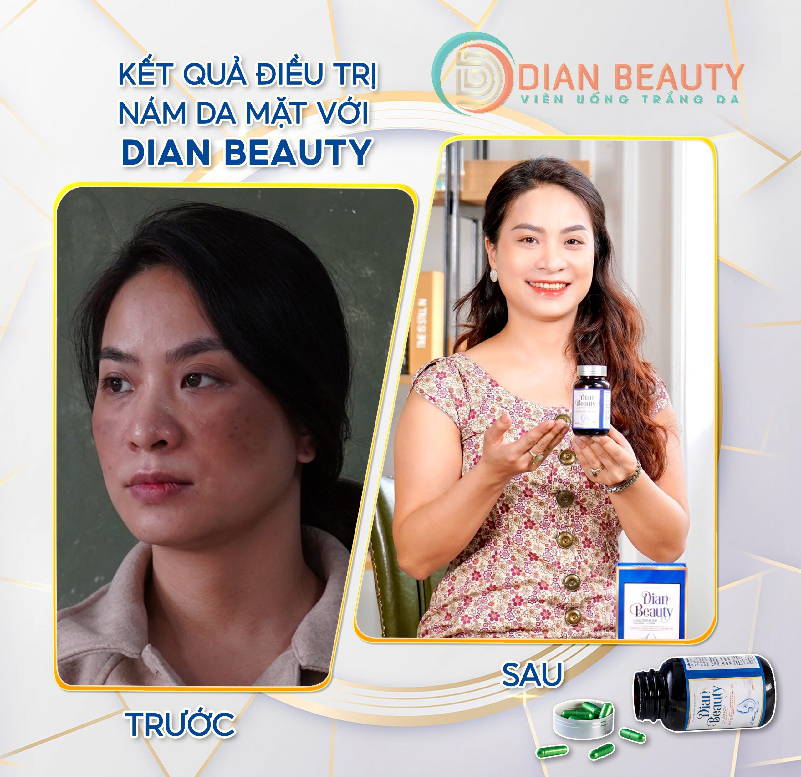 viên uống dian beauty